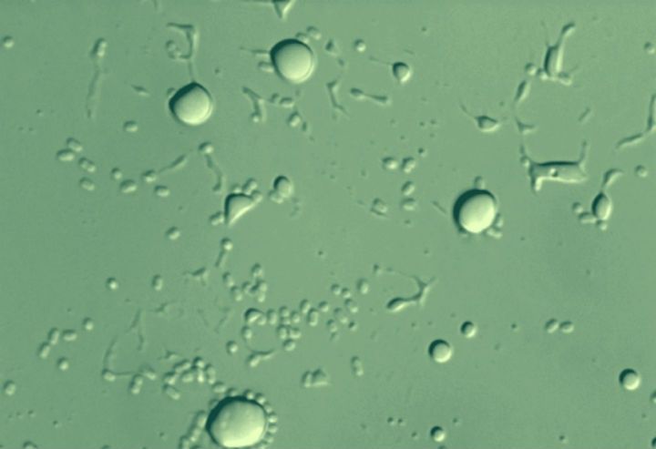 wpid-17198_batterio.jpg